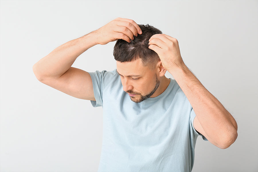 Mann fördert mit 5-ALA Haarwachstum