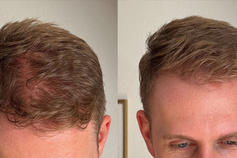 New Year – New Hair: Die richtige Haarpflege-Routine für sichtbar stärkeres und volleres Haar
