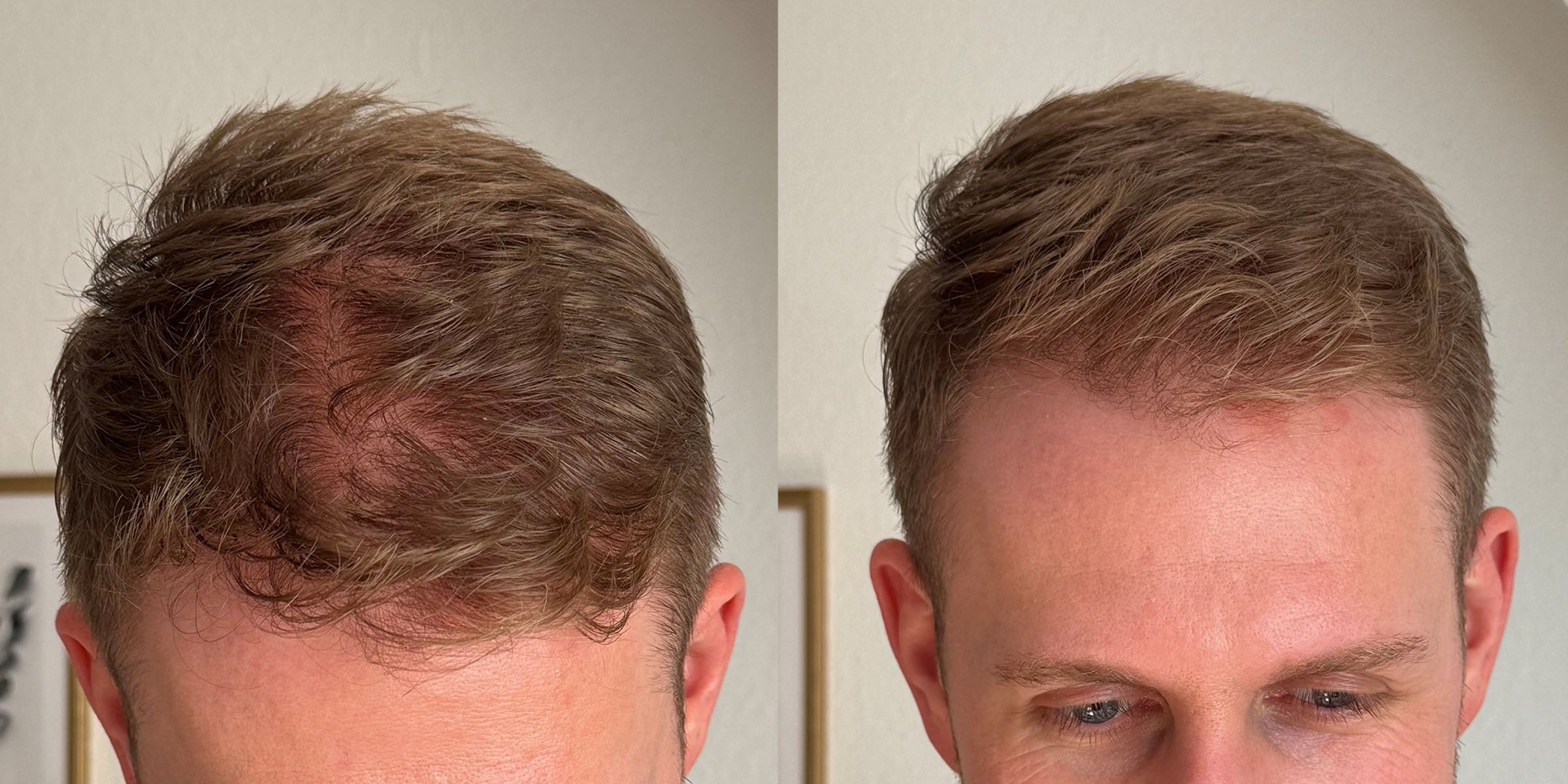 New Year – New Hair: Die richtige Haarpflege-Routine für sichtbar stärkeres und volleres Haar